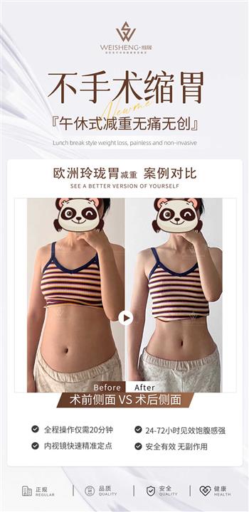 不手术缩胃