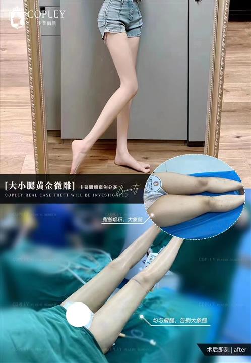 案例展示