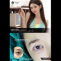 案例展示