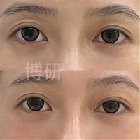 案例展示