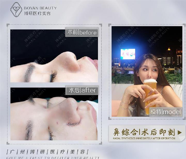 案例展示