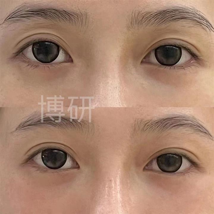 案例展示