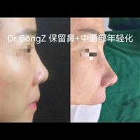 案例展示