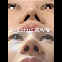 案例展示