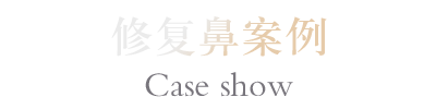 修复鼻案例