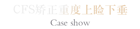 CFS矫正重度上睑下垂案例
